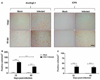 Herpes Simplex Virus Type 1 Enhances Expression of the Synaptic Protein Arc for Its Own Benefit